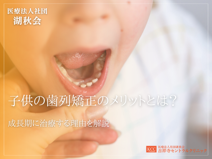 子供の歯列矯正のメリットとは？成長期に治療する理由を解説