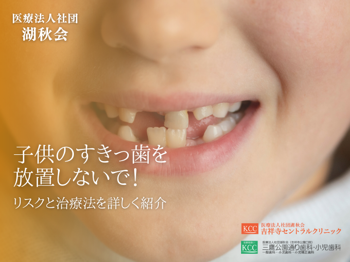 子供のすきっ歯を放置しないで！リスクと治療法を詳しく紹介