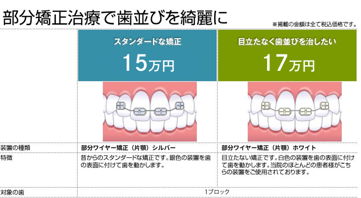 部分矯正で歯並びを綺麗に