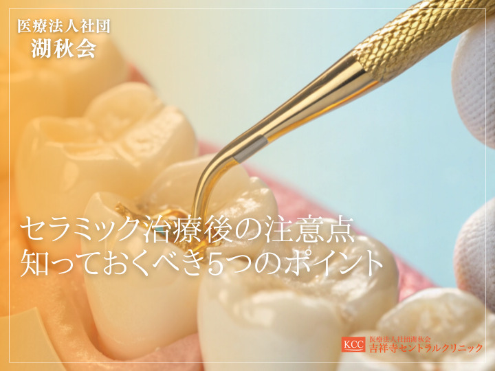 セラミック治療後の注意点：知っておくべき5つのポイント
