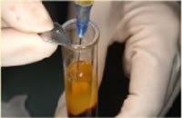 ２．血小板濃縮フィブリン液の抽出