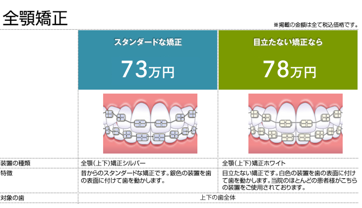全顎矯正