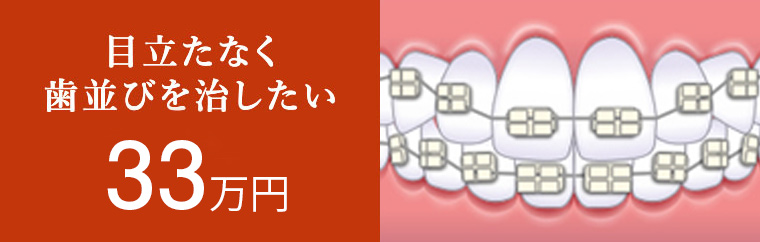 目立たない矯正 38万円