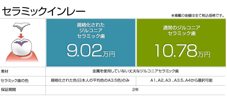 セラミックインレー