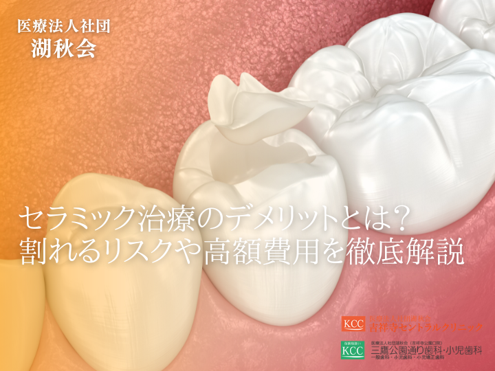 セラミック治療のデメリットとは？割れるリスクや高額費用を徹底解説