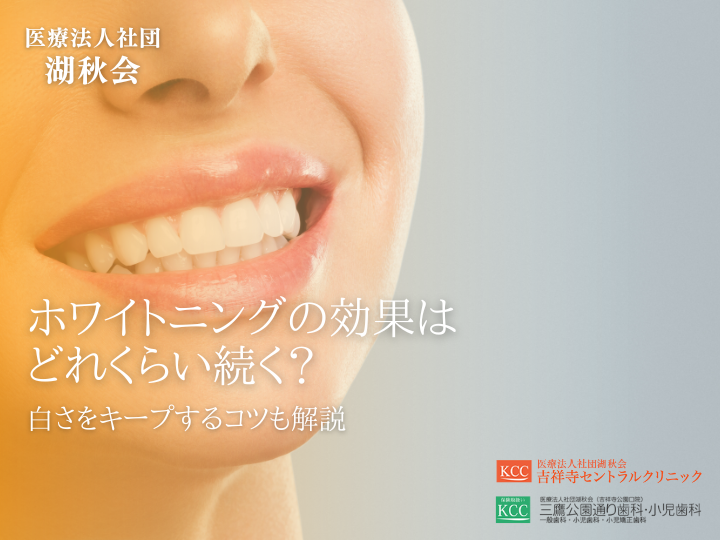 ホワイトニングの効果はどれくらい続く？白さをキープするコツも解説