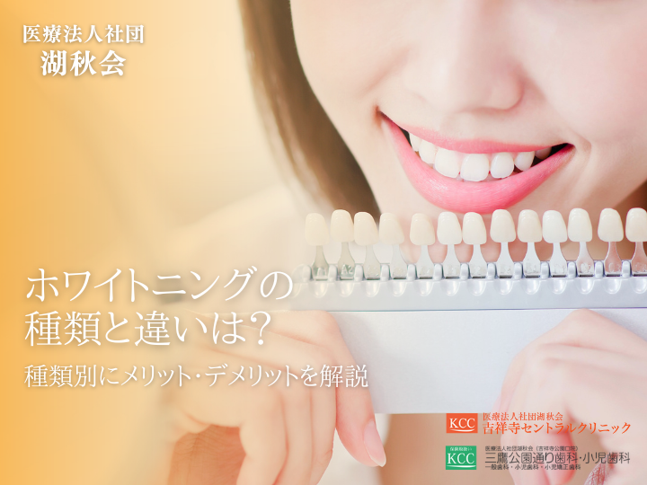 ホワイトニングの種類と違いは？種類別にメリット・デメリットを解説