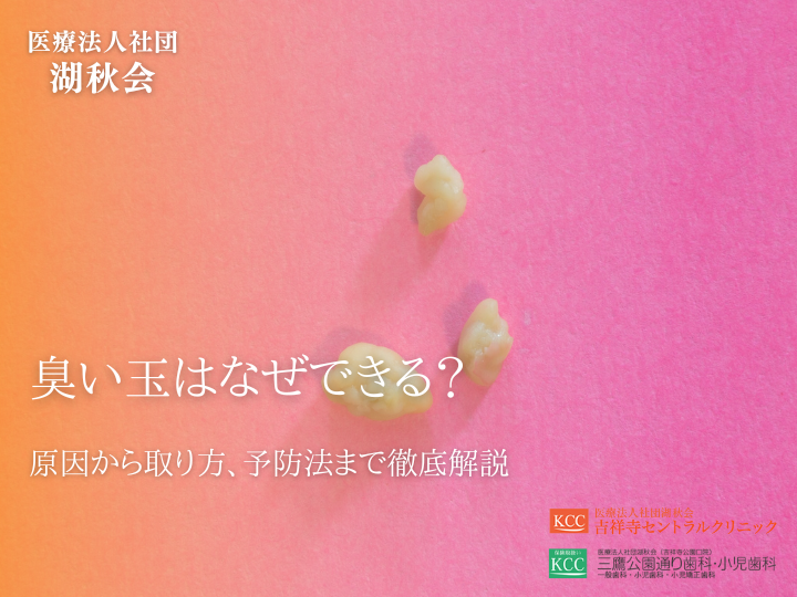 臭い玉はなぜできる？原因から取り方、予防法まで徹底解説